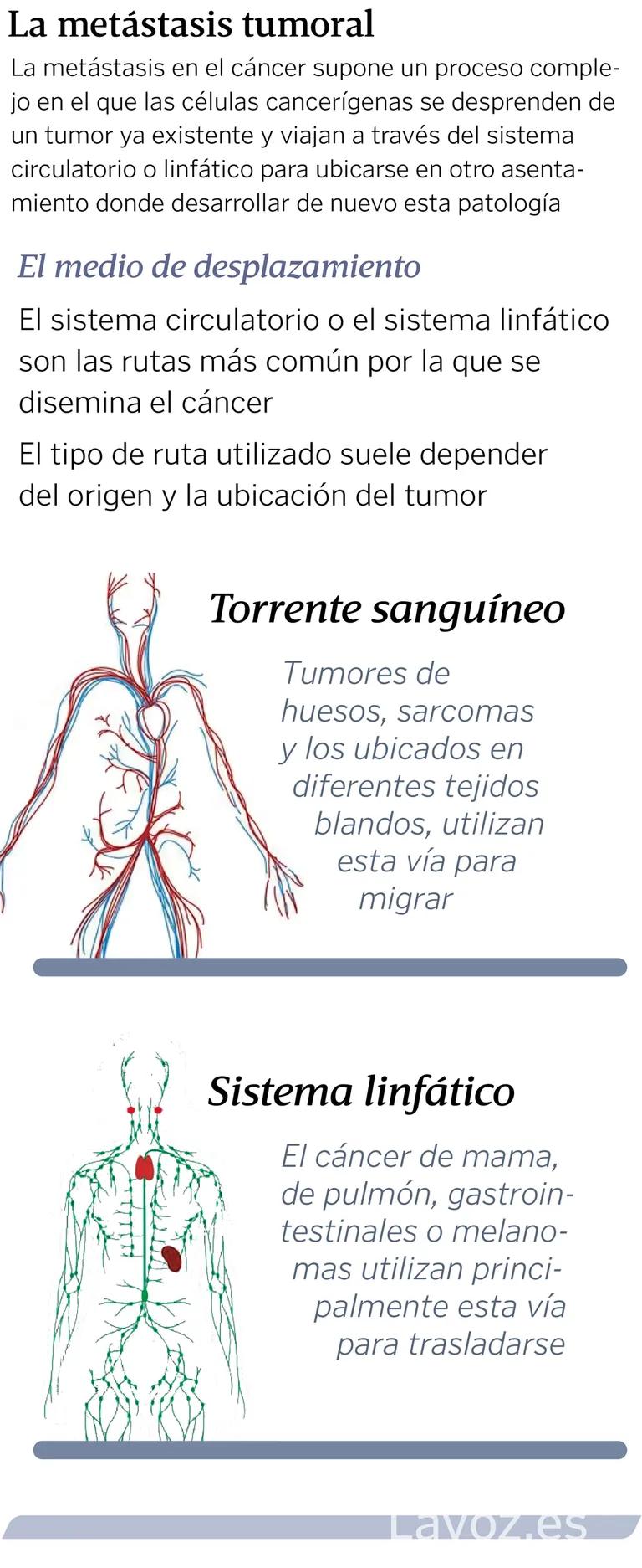 metástasis fue realizada en base a hechos reales - Cómo saber si el cáncer ha hecho metástasis