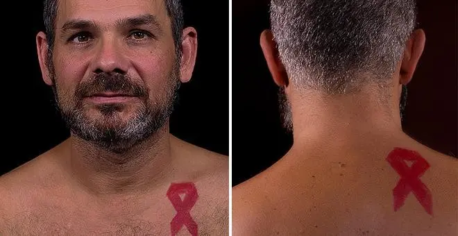 historias reales cntagiado del sida - Cómo se dieron cuenta que tenía SIDA