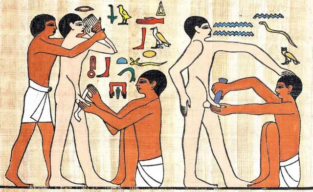 medicina hechos historicos egipto aportaciones - Qué avances realizó la civilizacion egipcia en medicina y Cirugía