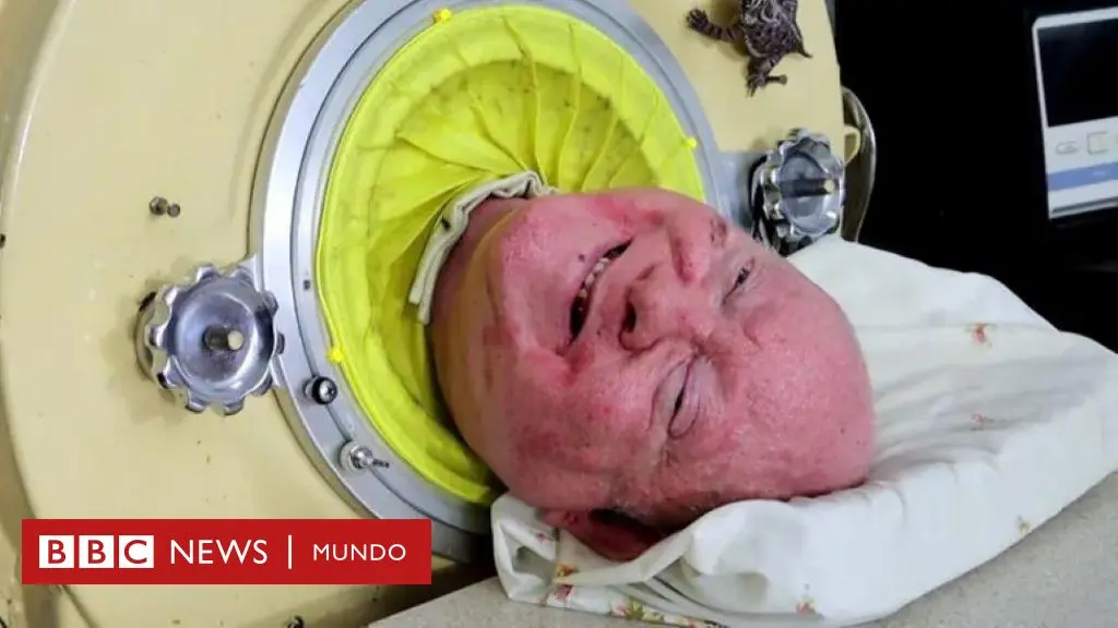 alexander historia real - Qué le pasó a Paul Alexander