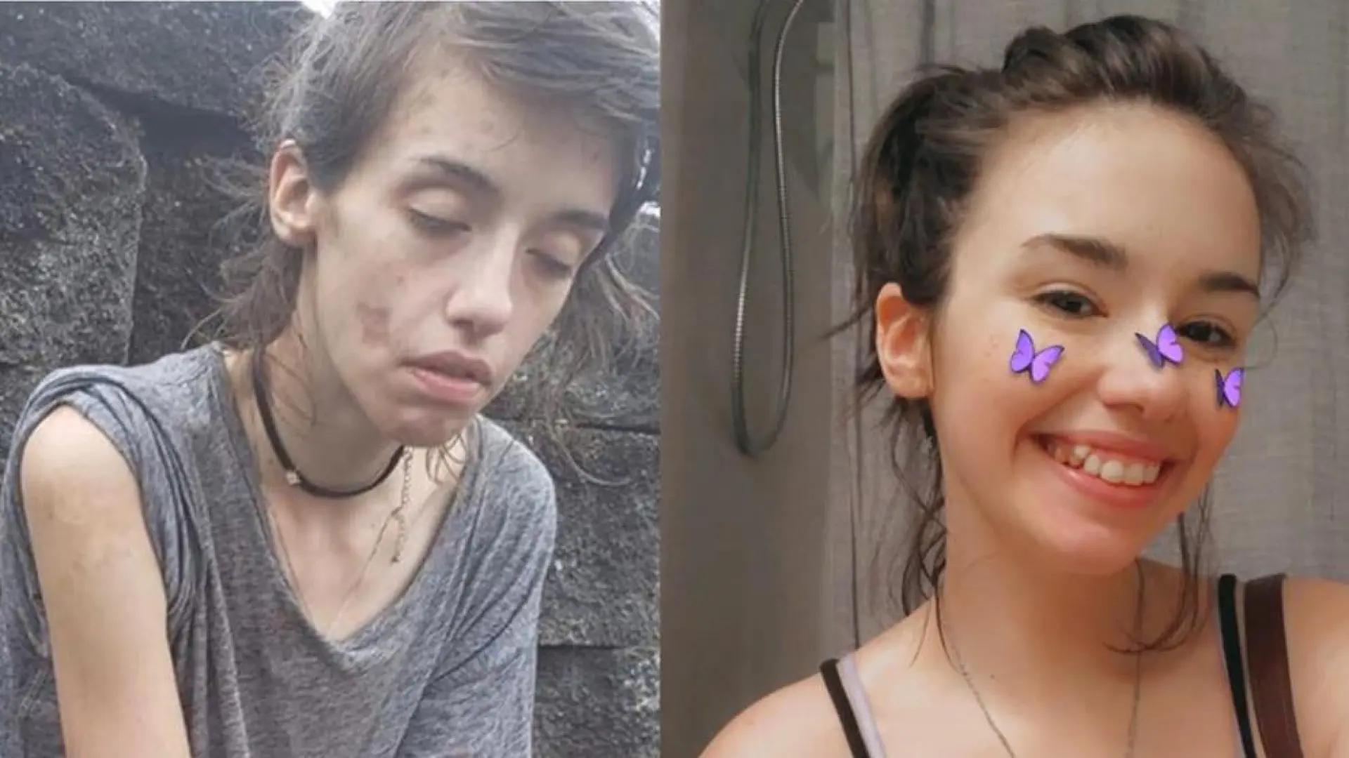 La Historia Real de Amber: Una Adolescente Luchando Contra la Adicción - Qué origina las adicciones en los adolescentes amber historia real adicción adolescente - Qué origina las adicciones en los adolescentes