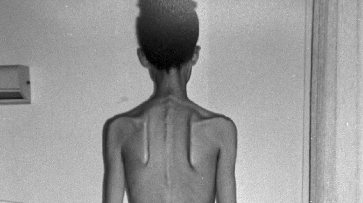 historias reales de una persona con bulimia y su nombre - Qué significa F50