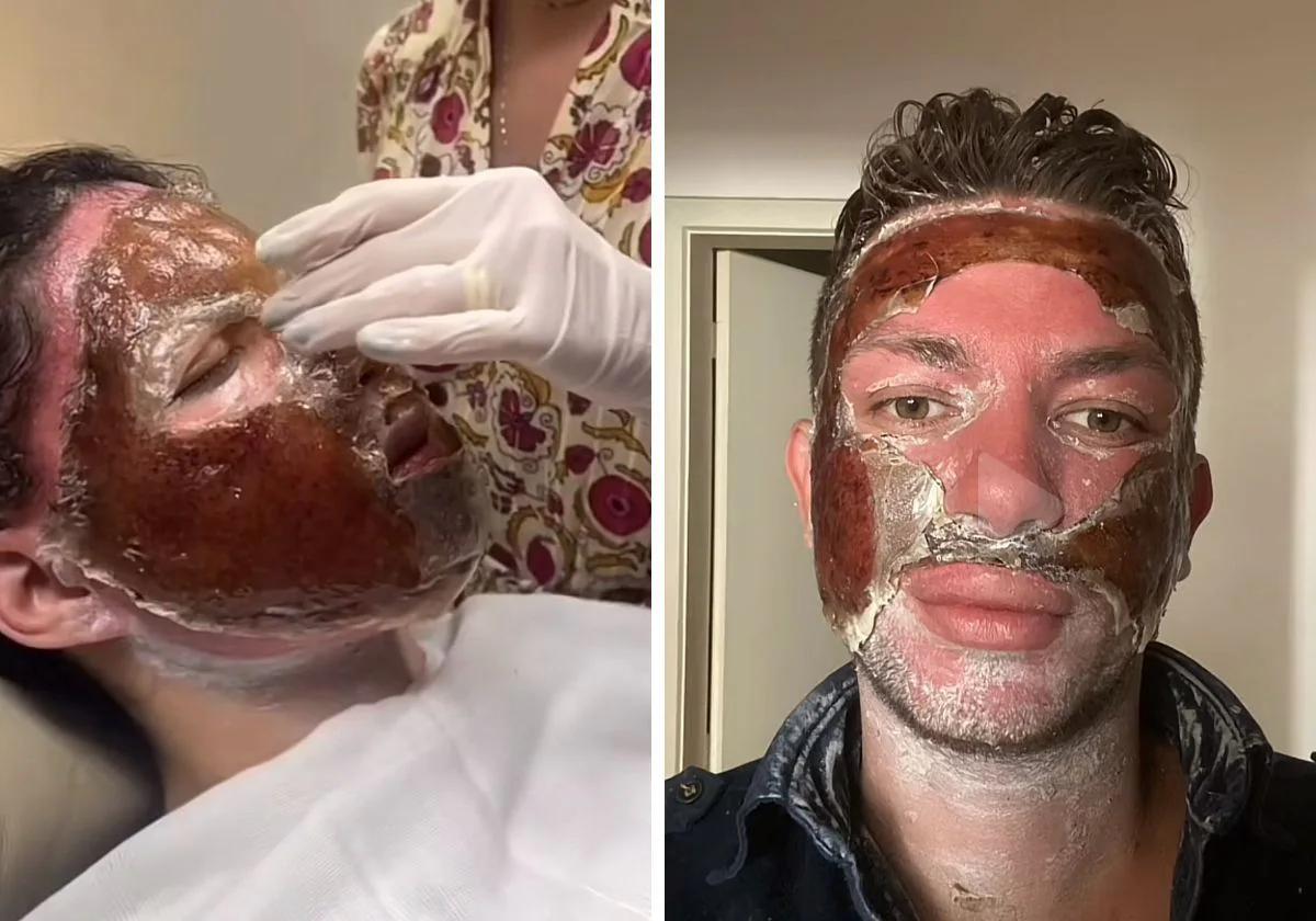 historias reales de daños a la piel - Qué son los trastornos dermatológicos